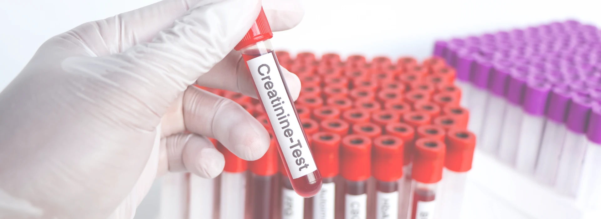 Toma de Muestras GRUMEDICAL